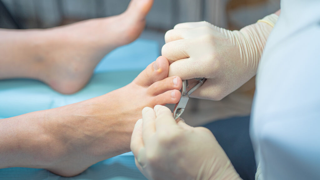 podologie soins des ongles incarnées