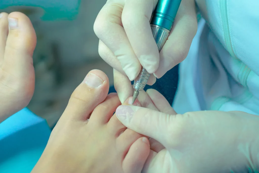 soins des pieds pédicure d'ongles